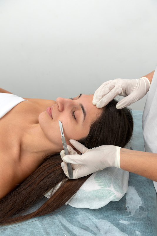 Discover Dermaplaning: Unveil Your Radiant Skin!