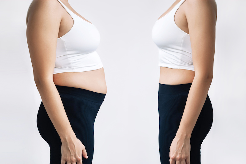Fat Cells After Noninvasive Body Contouring Treatment