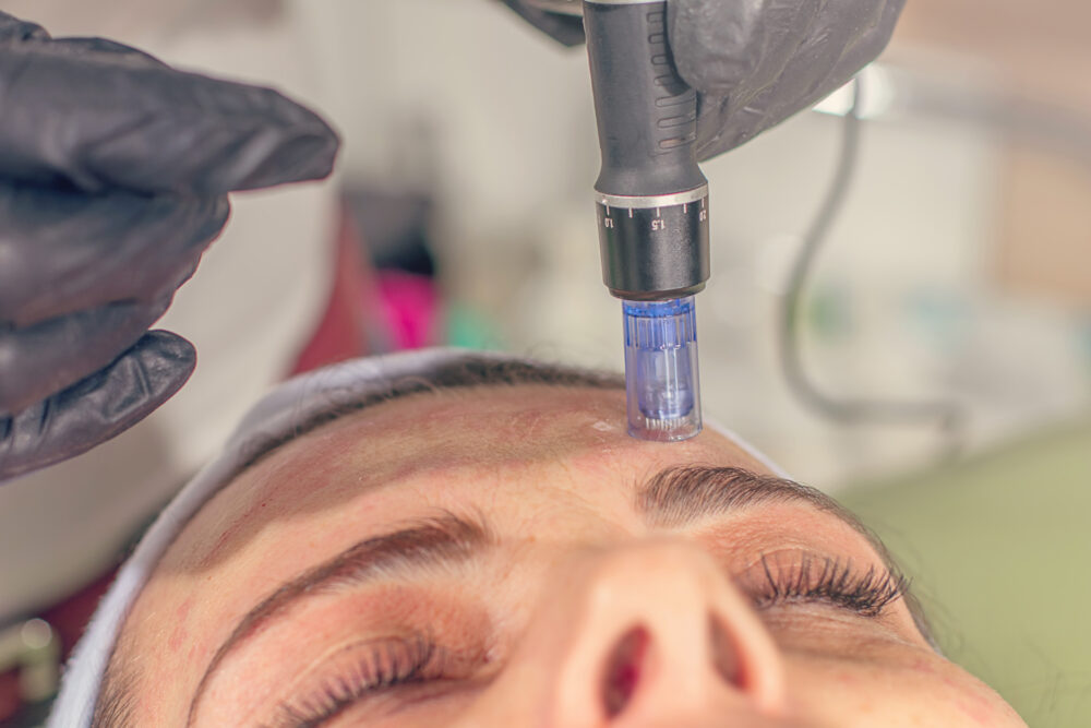 non-invasive cosmetic treatments non-invasive cosmetic treatments